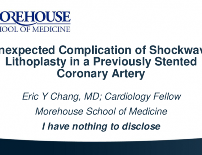 TCT 589: Unexpected Complication of Shockwave Lithoplasty in a Previously Stented Coronary Artery