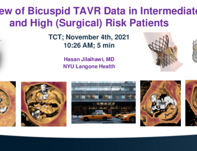 Review of Bicuspid TAVR Data in Intermediate and High-Risk Patients