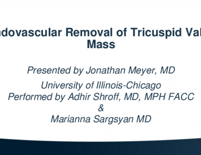 TCT 705: Endovascular Removal of Tricuspid Valve Mass 