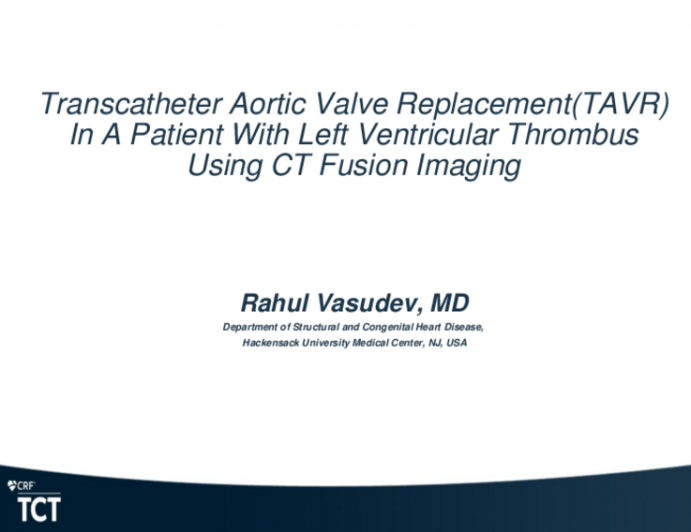 TCT 533: Transcatheter Aortic Valve Replacement(TAVR) In A Patient With Left Ventricular Thrombus Using CT Fusion Imaging