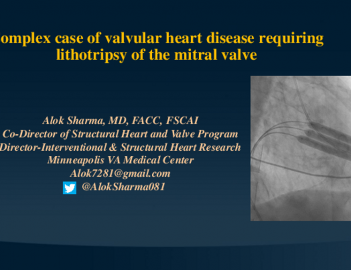 TCT 575: Complex Case of Valvular Heart Disease Requiring Lithotripsy of the Mitral Valve