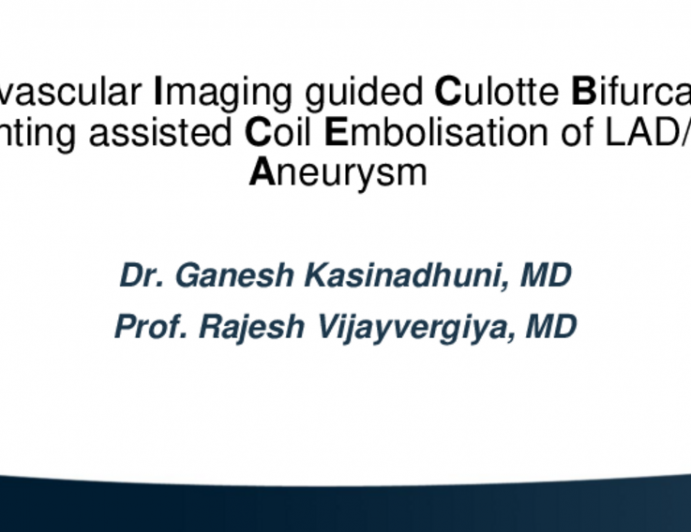 TCT 715: IVUS Guided Culotte Bifurcation Stenting Assisted Coil Embolisation Of LAD/D1 Bifurcation Aneurysm In A Patient With ANCA Positive Vasculitis