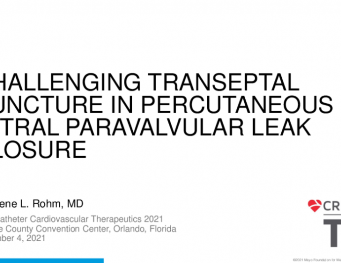 TCT 573: Challenging Transseptal Puncture for Percutaneous Mitral Paravalvular Leak Closure