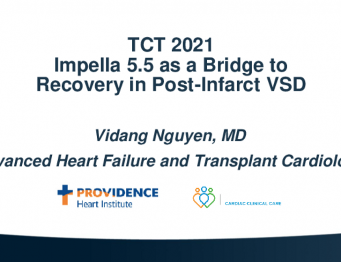 TCT 536: Impella 5.5 as a Bridge To Repair in a Post-Infarct Ventricular Septal Defect