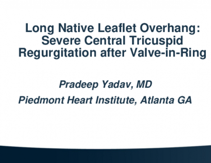 TCT 603: First Report: Long Native Leaflet Causing "Leaflet Overhang" Causing Severe Central Tricuspid Regurgitation After Valve-In-Ring With Sapien 3 Valve