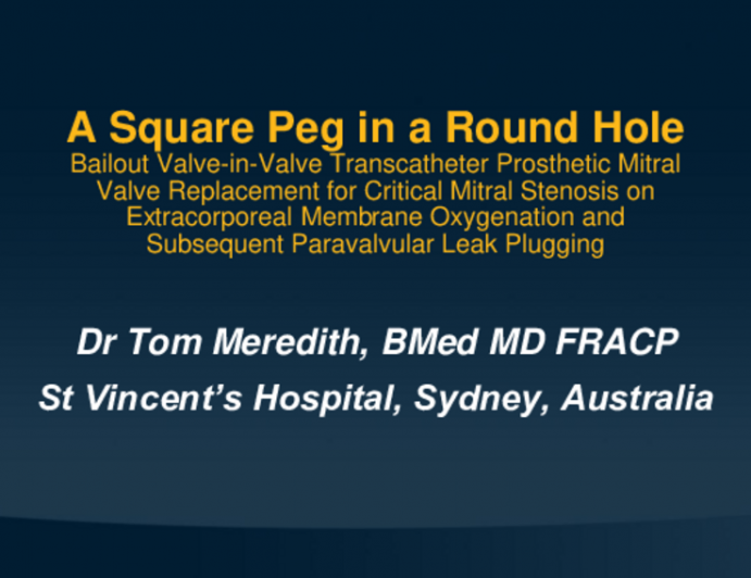 A Square Peg in a Round Hole - Bailout Valve-in-Valve Transcatheter Prosthetic Mitral Valve Replacement for Critical Mitral Stenosis on Extracorporeal Membrane Oxygenation and Subsequent Paravalvular Leak Plugging