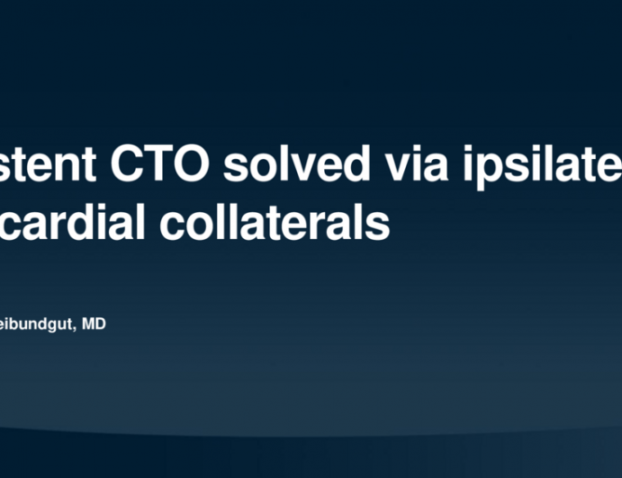 TCT 671: In-stent CTO solved via ipsilateral epicardial collaterals