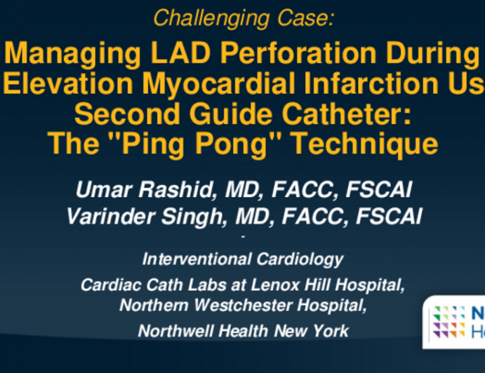 TCT 650: Managing LAD Perforation During ST Elevation Myocardial Infarction Using Second Guide Catheter: The "Ping Pong" Technique