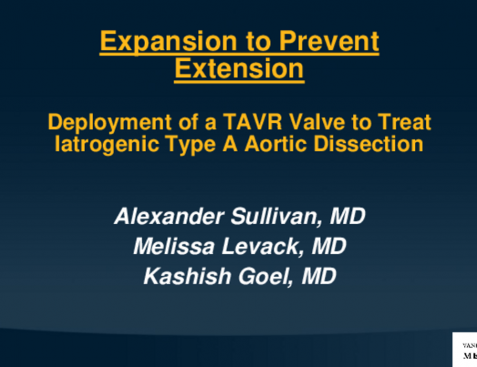 TCT 525: Expansion to Prevent Extension: Deployment of TAVR Valve to Treat Iatrogenic Type A Aortic Dissection