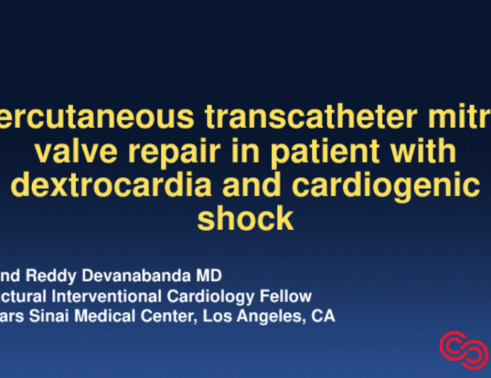 TCT 582: Percutaneous Transcatheter Mitral Valve Repair In Patient With Dextrocardia And Cardiogenic Shock