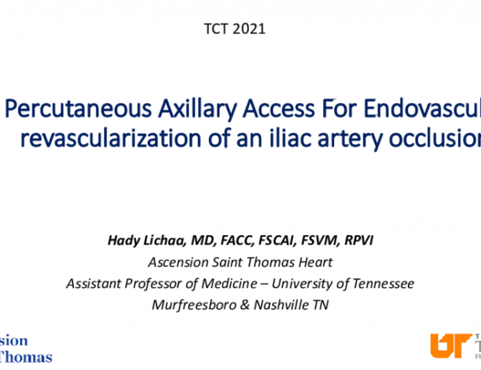 TCT 592: Percutaneous Axillary Access For Endovascular Iliac Artery Revascularization, Including CO2 Angiography, IVUS Based Re-Entry and Lithoplasty, In The Setting Of Bilateral Hostile Groins