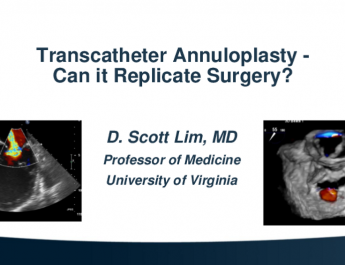 Transcatheter Annuloplasty - Can it Replicate Surgery