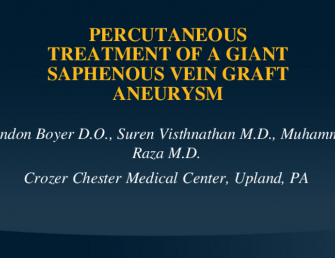 TCT 606: Percutaneous Treatment of a Giant Saphenous Vein Graft Aneurysm