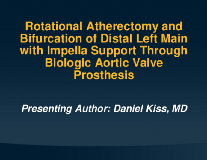 TCT 716: Rotational Atherectomy and Bifurcation of Distal Left Main with Impella Support Through Biologic Aortic Valve Prosthesis