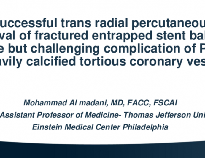 TCT 625: Successful trans radial percutaneous retrieval of fractured entrapped stent balloon inside right coronary artery deployed stent after fracture…