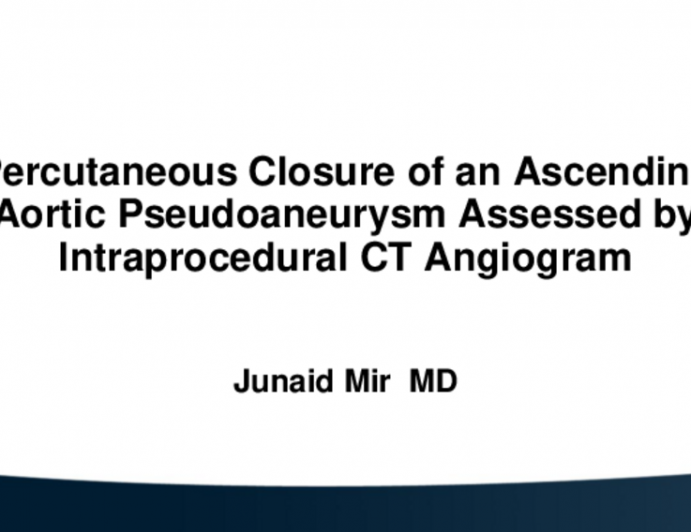 TCT 521: Percutaneous Transcatheter Closure of an Ascending Aortic Pseudoaneurysm Assessed by Intraprocedural CT Angiogram