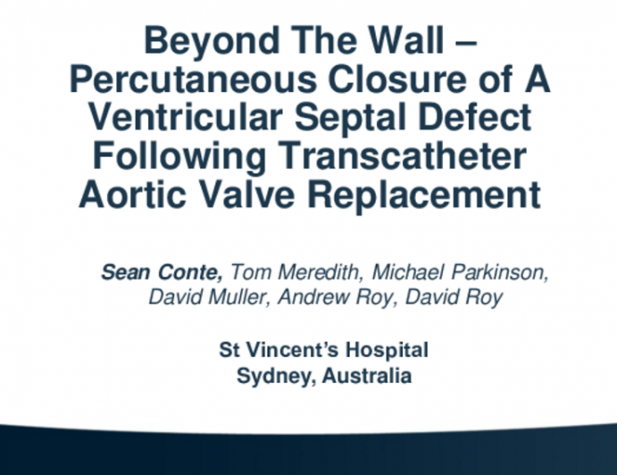 TCT 707: Beyond The Wall – Percutaneous Closure of A Ventricular Septal Defect Following Transcatheter Aortic Valve Replacement