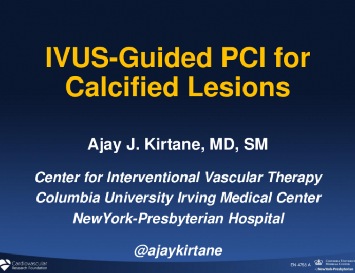 IVUS Guided PCI for Calcified lesions