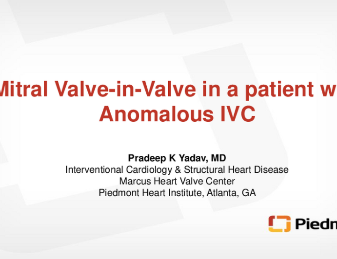 Trans Jugular Mitral Valve-In-Valve in Patient With Anomalous Inferior Vena Cava