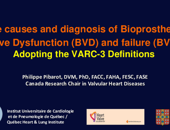 The Causes and Diagnosis of Bioprosthetic Valve Failure: Adopting the VARC-3 Consensus Definitions