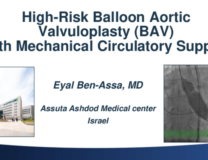 A CASE OF… High-Risk Balloon Aortic Valvuloplasty (BAV) With Mechanical Circulatory Support