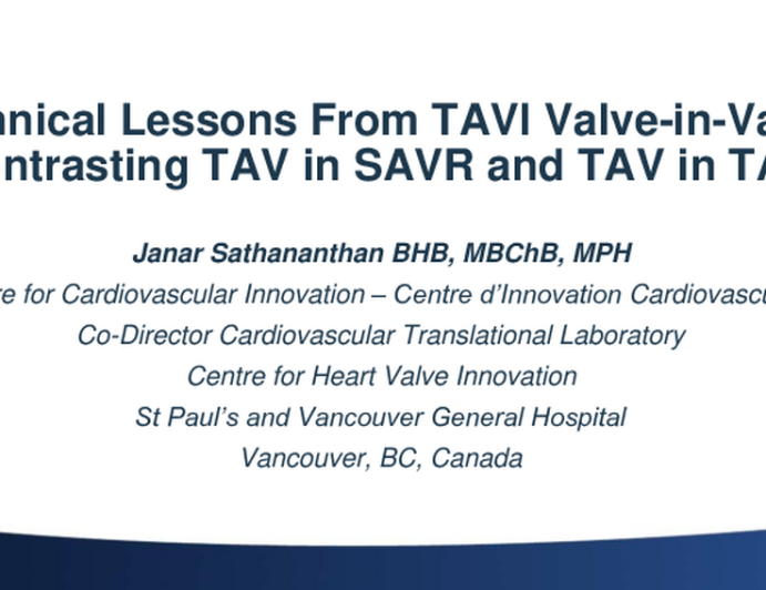 Technical Lessons From TAVI Valve-in-Valve: Contrasting TAV in SAVR and TAV in TAV