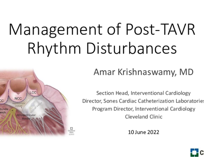 Post-procedural Management of Conduction Disturbances, Including MCOT