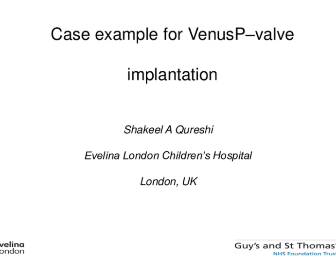 VenusP-Valve Recorded Case