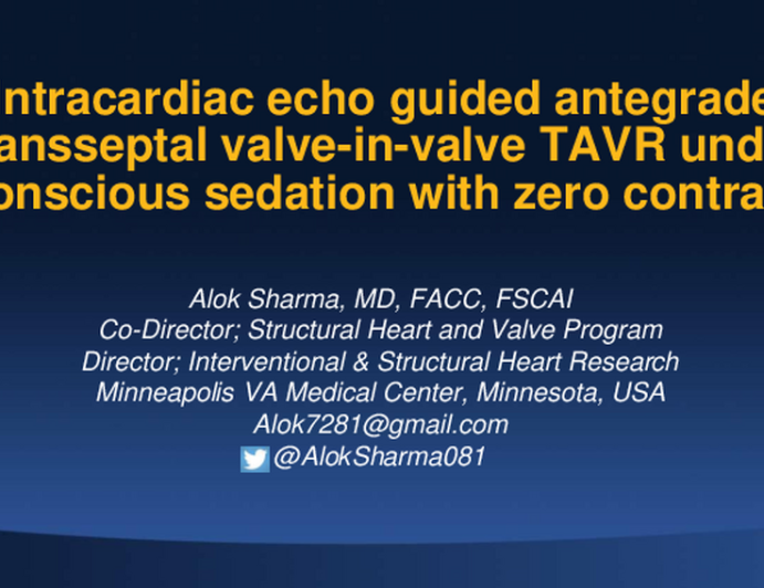 Intracardiac echocardiography guided antegrade transseptal valve-in-valve TAVR under conscious sedation with zero contrast