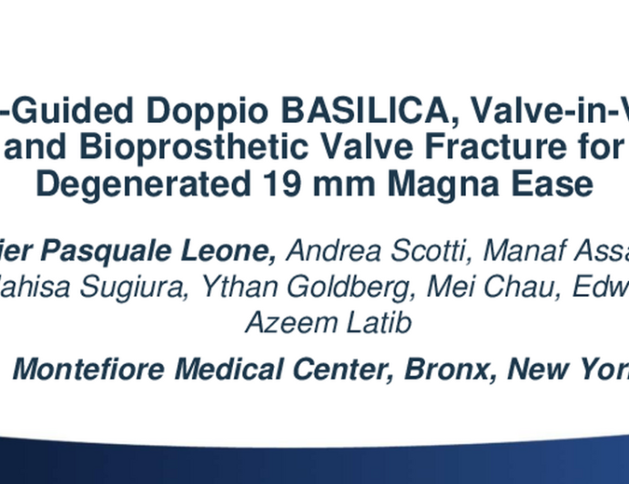IVUS-Guided Doppio BASILICA, Valve-in-Valve, and Bioprosthetic Valve Fracture for Degenerated 19 mm Magna Ease