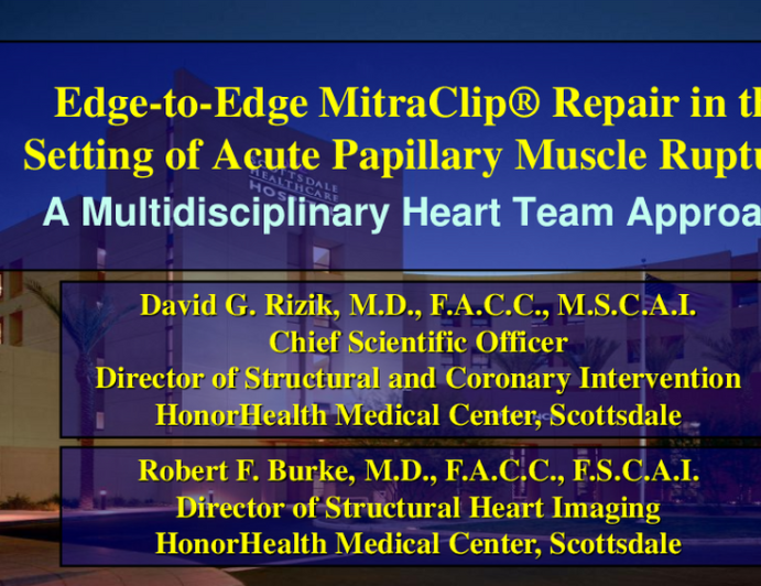 #4 Case Presentation: Acute Heart Failure Following Mitral Valve Intervention