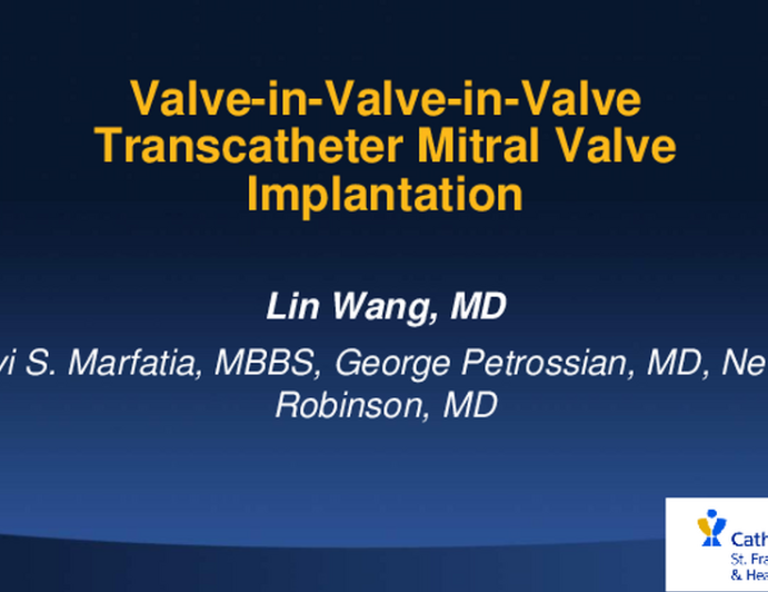 Valve-in-Valve-in-Valve Transcatheter Mitral Valve Implantation to Treat Paravalvular Leak