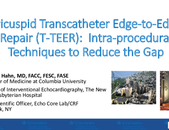 Facilitated Tricuspid-TEER With Reverse Trendelenburg: Technique and Outcomes