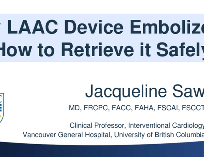 My LAAC device embolized, how to retrieve it safely!
