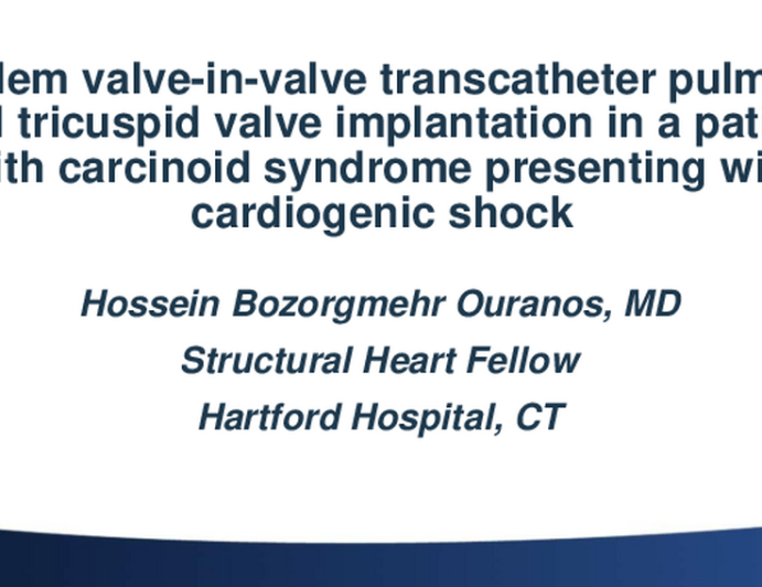 Tandem valve-in-valve transcatheter pulmonic and tricuspid valve implantation in a patient with carcinoid syndrome presenting with cardiogenic shock