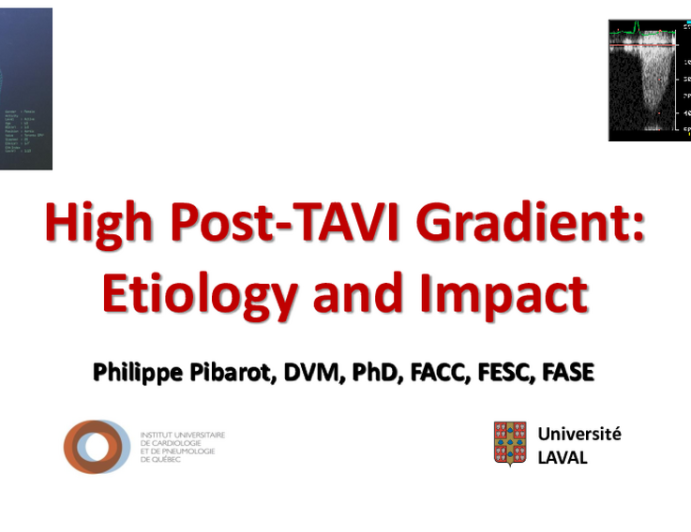 High Post-TAVR Gradient: Etiology and Outcomes