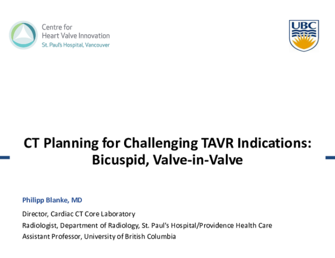 CT Planning for Challenging TAVR Indications:  Bicuspid, Preventing Coronary Obstruction, Valve-in-Valve