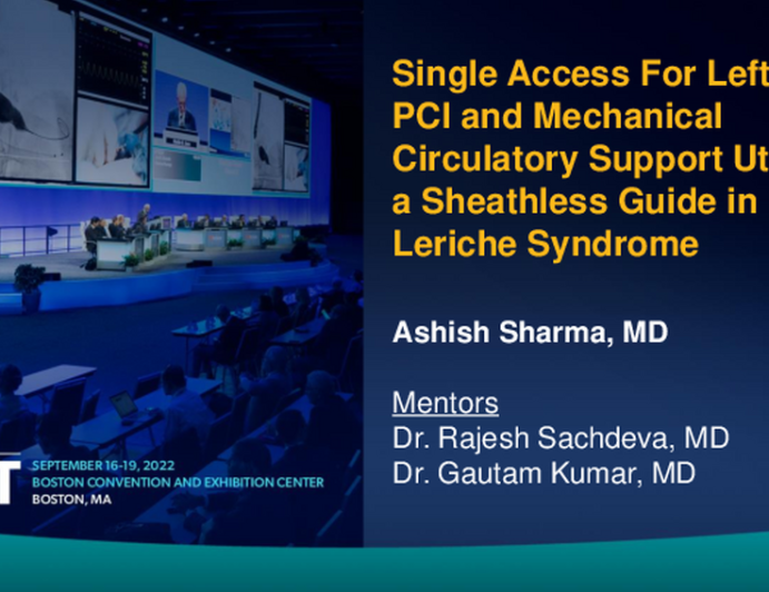 TCT 712: Single Access for Impella and PCI With Sheathless Guide Catheter via Axillary Approach