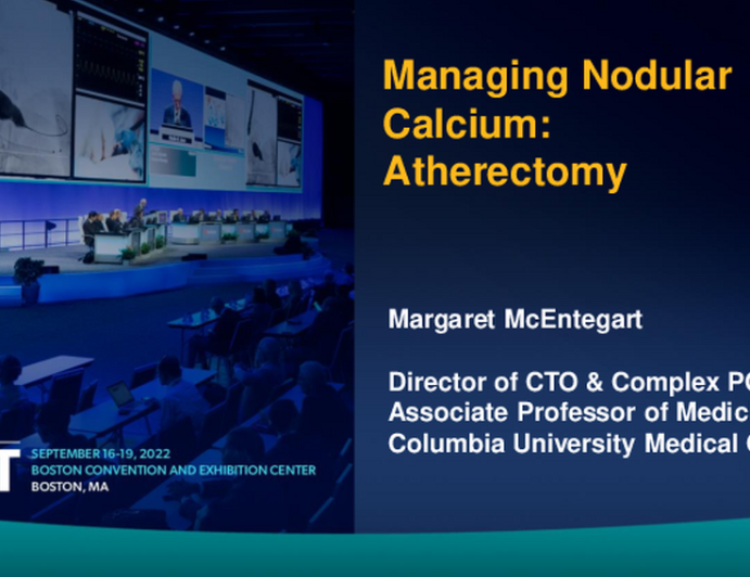 Managing Nodular Calcium with Atherectomy