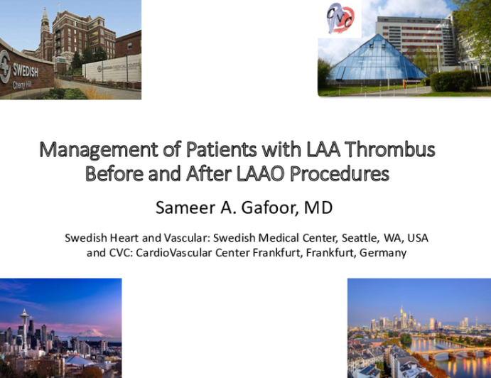 Keynote Lecture: Management of Patients with LAA Thrombus (Before or After LAAO Procedures)