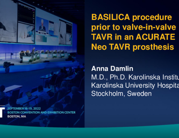 TCT 610: BASILICA procedure prior to valve-in-valve TAVR in an ACURATE Neo TAVR prosthesis