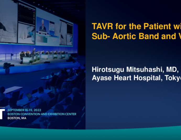 TCT 768: TAVR for the Patient with Sub-Aortic Valve Band and VSD