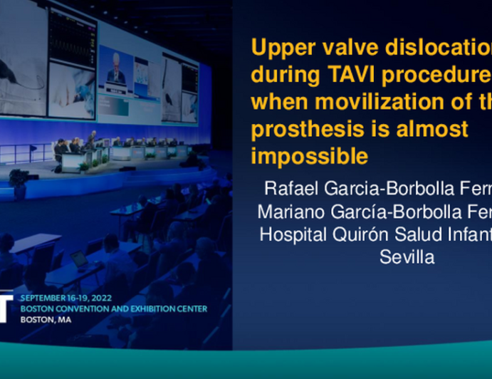 TCT 779: Upper valve dislocation during TAVI procedure: when movilization of the prosthesis is almost impossible