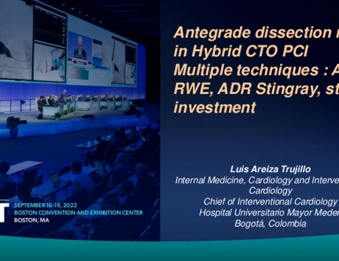 TCT 656: Antegrade dissection reentry in Hybrid CTO PCIMultiple techniques : AWE, RWE, ADR Stingray, straw, investment