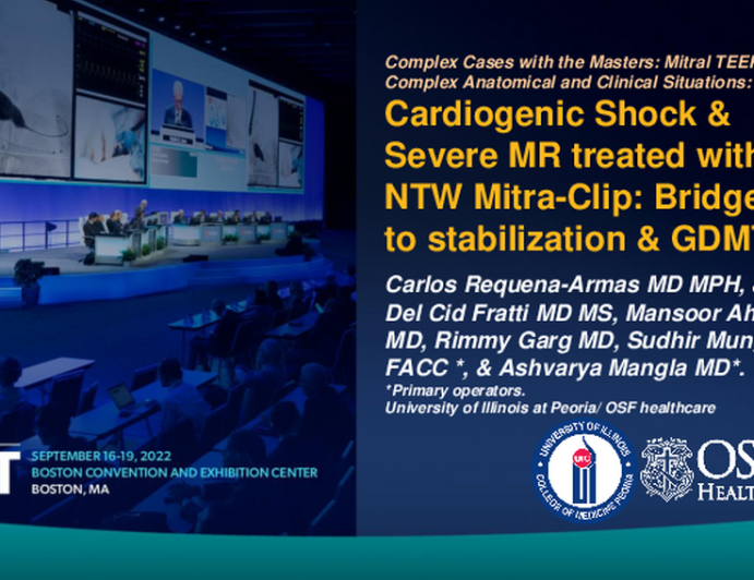 TCT 808: Cardiogenic Shock & Severe MR treated with NTW MitraClip: Bridge to stabilization - GDMT