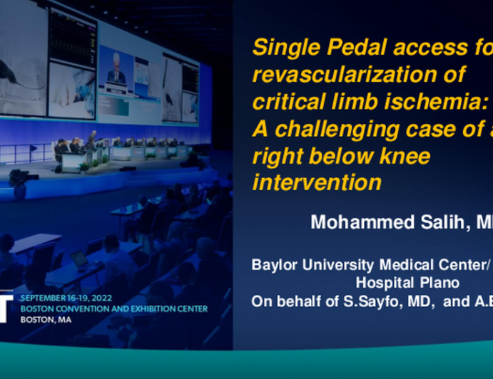 TCT 647: Single Pedal access for revascularization of critical limb ischemia:  A challenging case of a unilateral pedal-to-pedal intervention