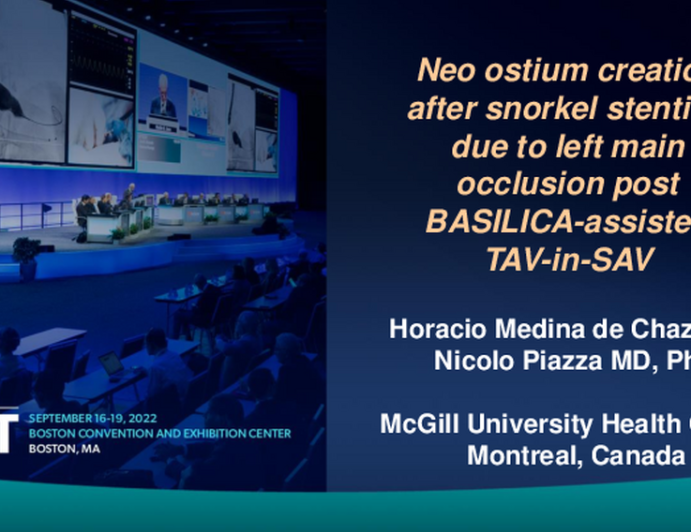 TCT 627: Neo ostium creation after snorkel stenting due to left main occlusion post BASILICA and valve-in-valve TAVR