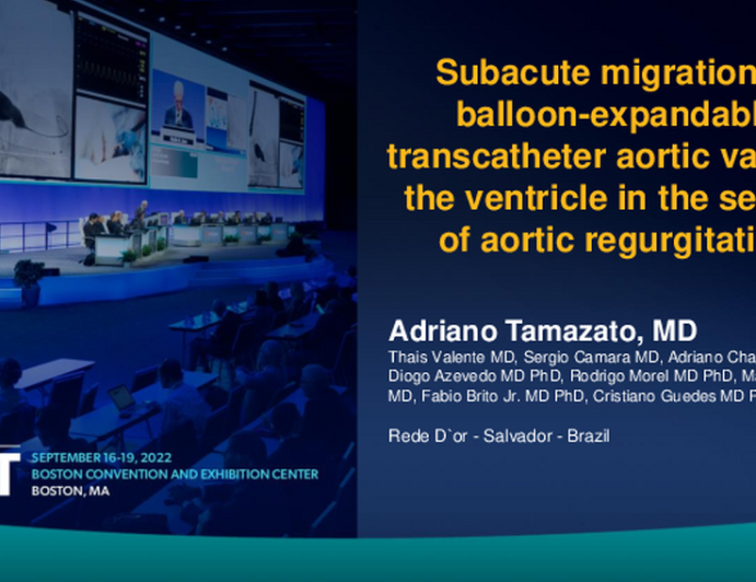 TCT 719: Subacute migration of balloon-expandable transcatheter aortic valve to ventricle in the Setting of Aortic Regurgitation