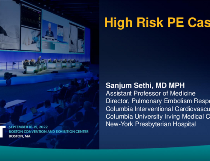 High-Risk PE Case (NewYork-Presbyterian/Columbia University Irving Medical Center): Case Introduction