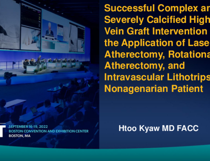 TCT 728: Successful Complex and Severely Calcified High-Risk Vein Graft Intervention With the Application of Laser Atherectomy, Rotational Atherectomy, and Intravascular Lithotripsy in A Nonagenarian Patient